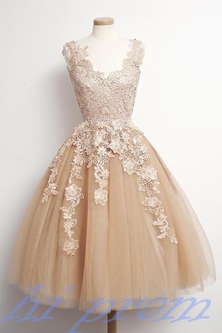 Prom Gown,homecoming Dress,lace Homecoming Dresses,knee Length Prom Gown,champagne Homecoming Gowns,2015 Homecoming Dress,ball Gown Homecoming